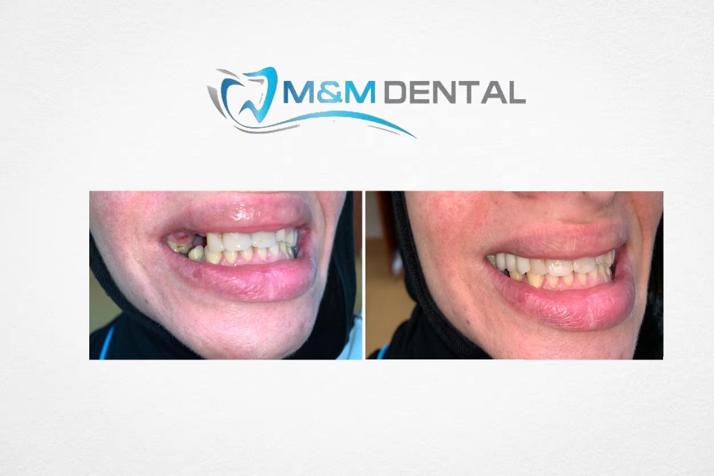 Home - MM Dental