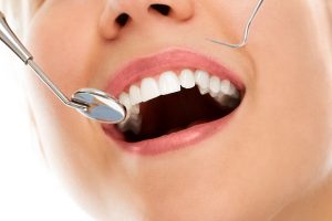Read more about the article Why Do Marsden Park Residents Need Regular Dental Check-Ups?