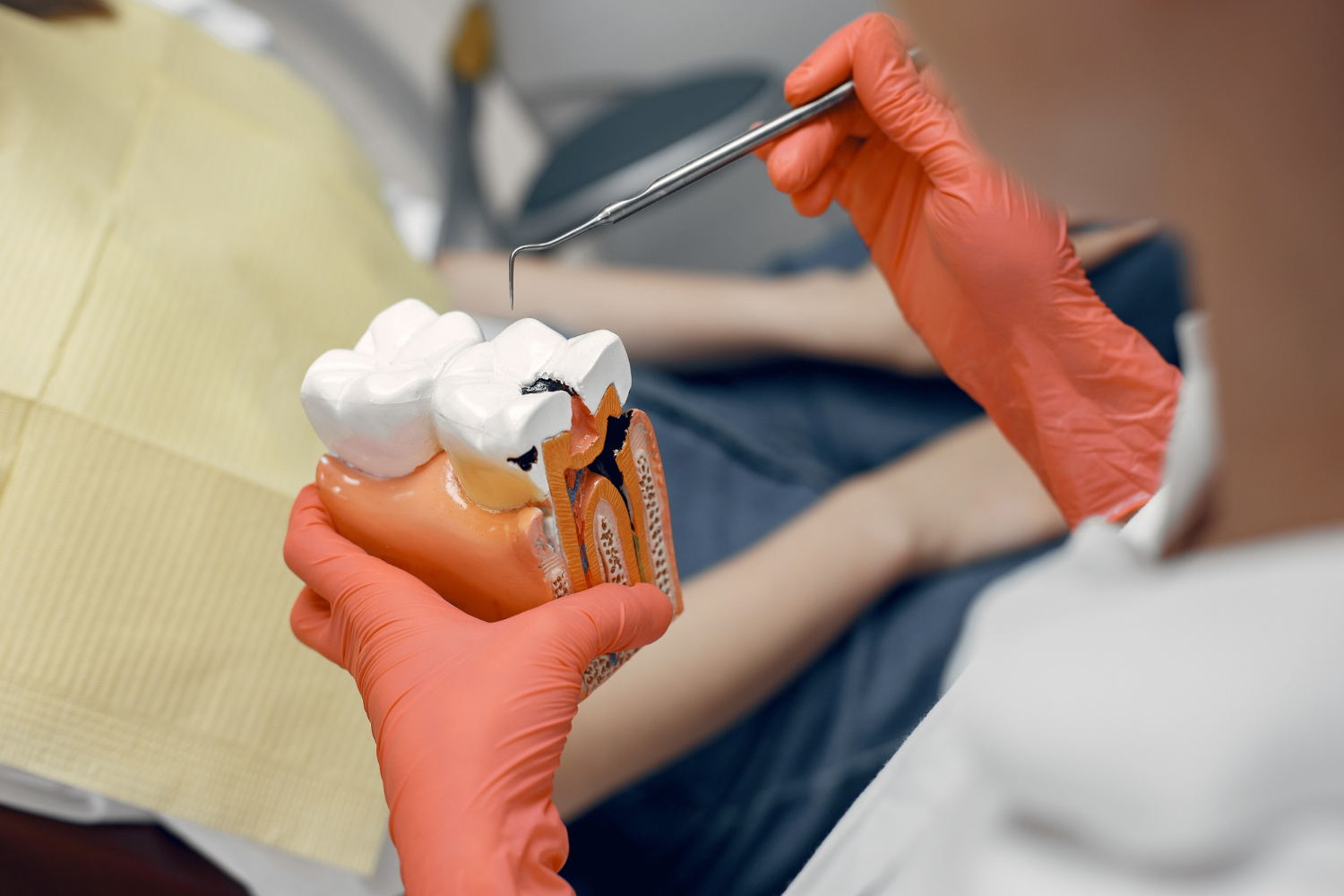 You are currently viewing Blacktown Root Canal Treatment: Saving Your Natural Teeth
