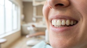 Read more about the article Replace Missing Teeth in Marsden Park
